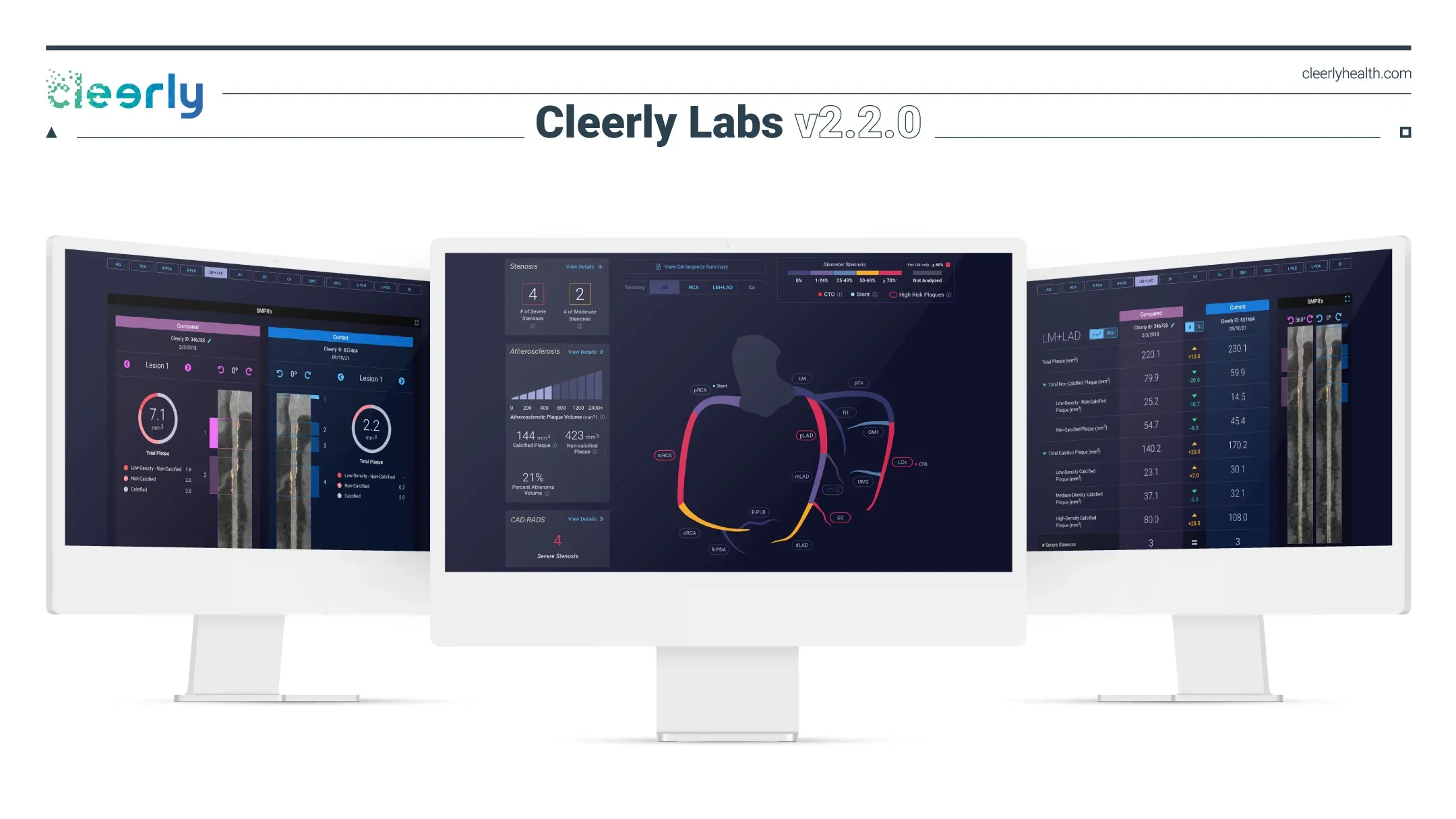 Cleerly Labs